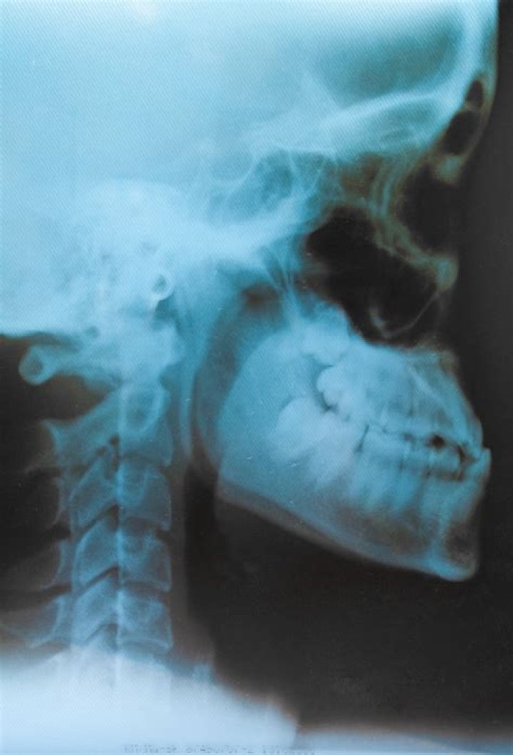 ¿Cuánto cuesta una radiografía de la cabeza?