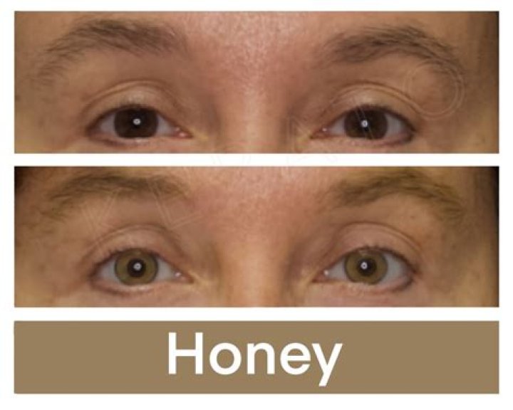 Does honey really change eye color?