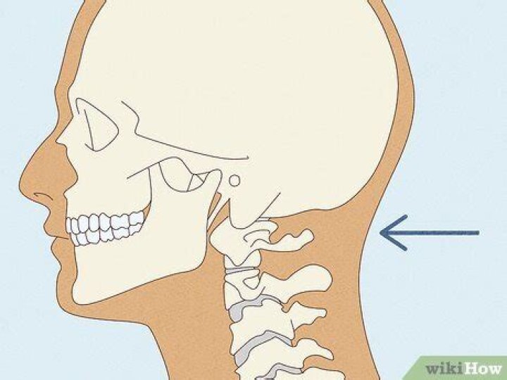 What body part is the nape?