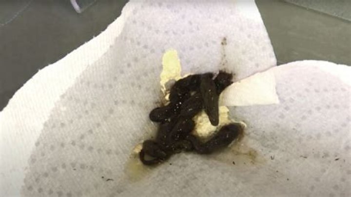 What does garter snakes poop look like?